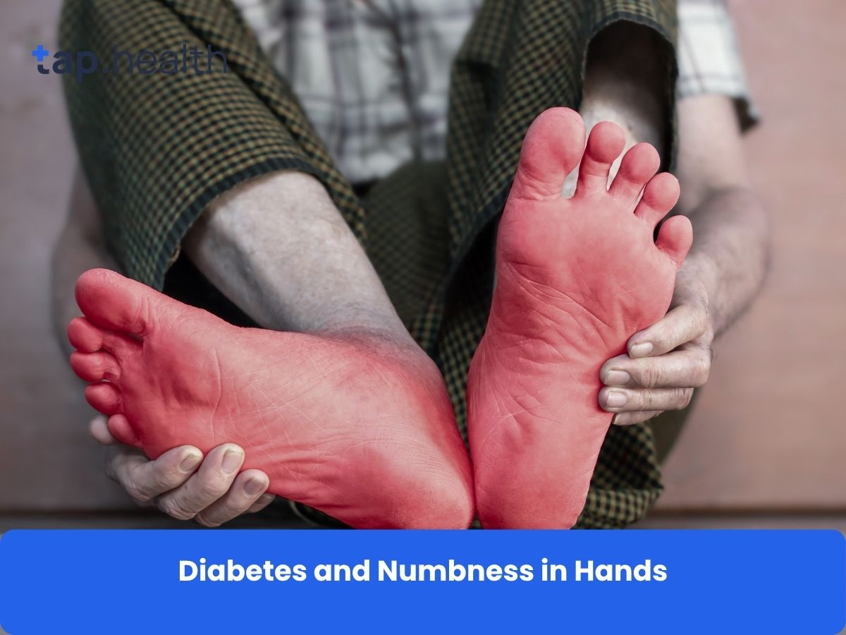 Diabetes and Numbness in Hands