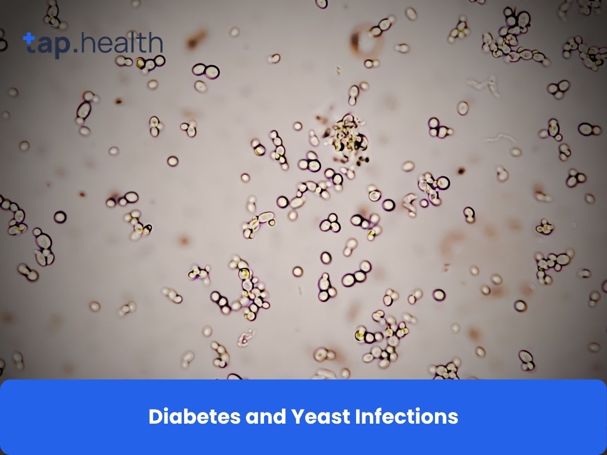 Diabetes and Yeast Infections