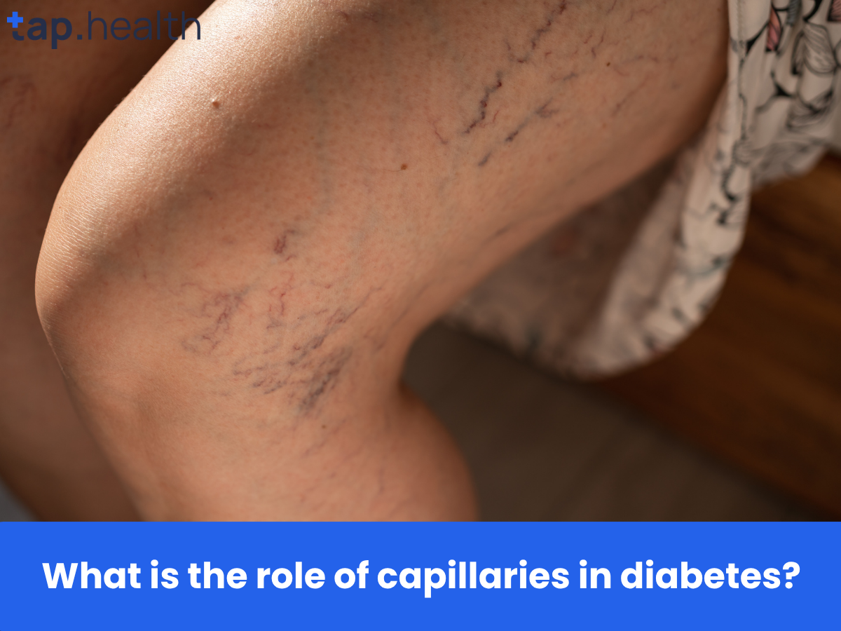 What is the role of capillaries in diabetes