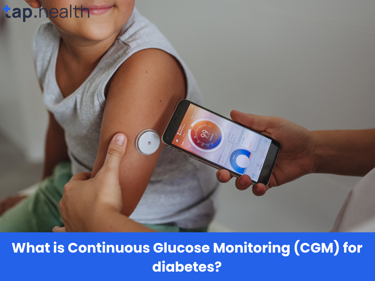 What is Continuous Glucose Monitoring (CGM) for diabetes